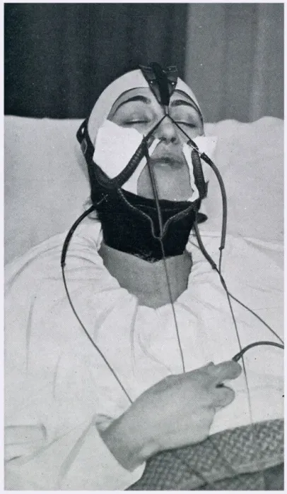 Framed Print : Apparatus for the Removal of the Double Chin 1927 Framed Print : Apparatus for the Removal of the Double Chin 1927