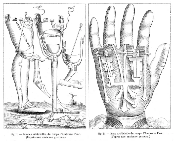 Framed Print : Artificial Limbs, France 16th Century Framed Print : Artificial Limbs, France 16th Century