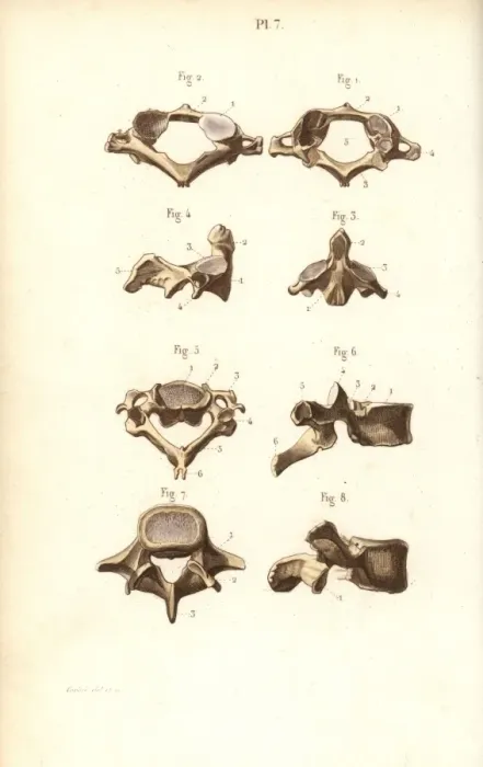 Framed Print : Axis and vertebrae Framed Print : Axis and vertebrae