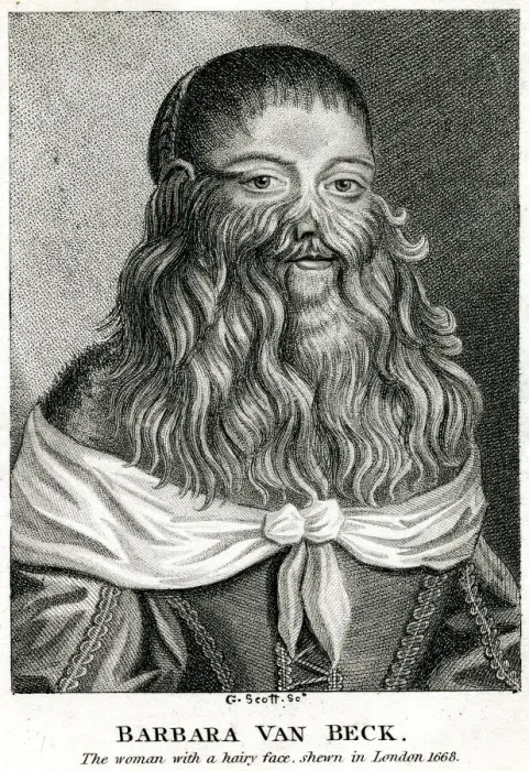 Framed Print : Barbara Urslerin, bearded girl from Germany Barbara Urslerin Framed Print : Barbara Urslerin, bearded girl from Germany Barbara Urslerin