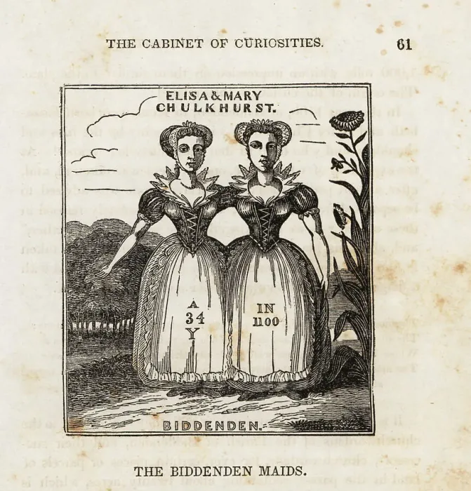 Framed Print : The Biddenden Maids, 11th century conjoined twins Framed Print : The Biddenden Maids, 11th century conjoined twins