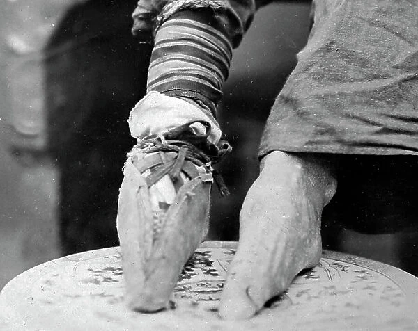 Bound feet, China, early 1900s