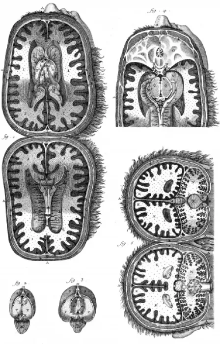 Framed Print : Brain Cavities 18th C