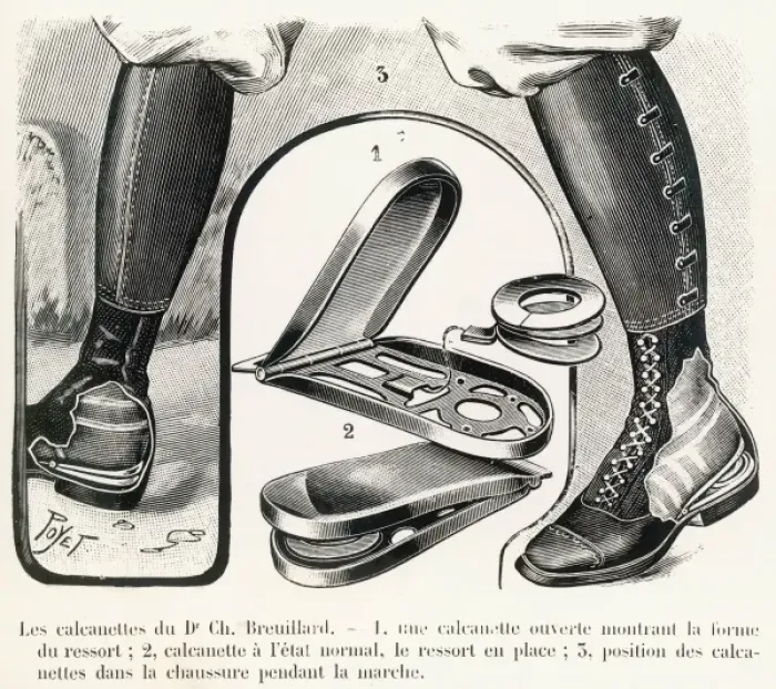 Framed Print : Breuillards device to assist walking Framed Print : Breuillards device to assist walking