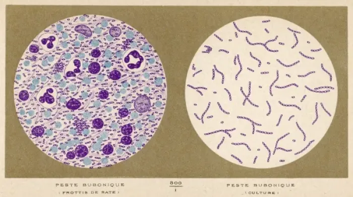 Framed Print : Bubonic Plague Bacillus Framed Print : Bubonic Plague Bacillus