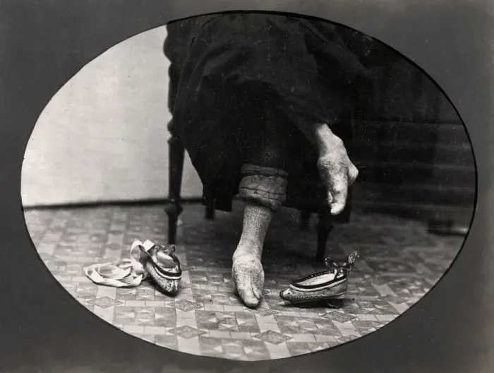 Framed Print : Chinese woman with bound feeet, China, 19th century Framed Print : Chinese woman with bound feeet, China, 19th century