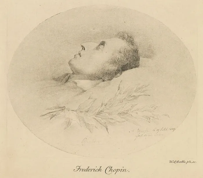 Framed Print : CHOPIN / DEATHBED Framed Print : CHOPIN / DEATHBED