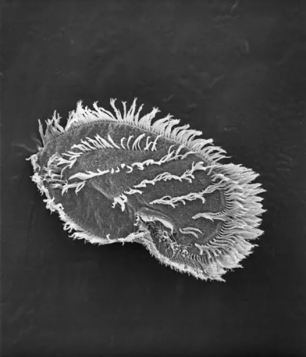 Framed Print : Ciliate plankton Framed Print : Ciliate plankton