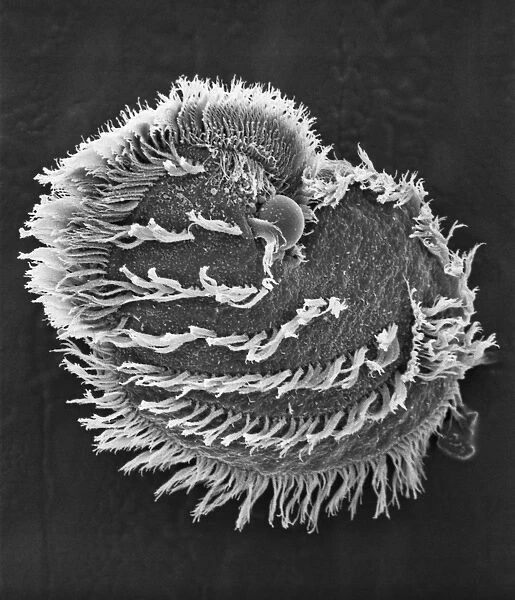 Ciliate plankton. Scanning electron microscope image of a ciliate showing