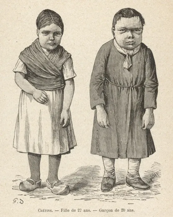Framed Print : TWO CRETINS Framed Print : TWO CRETINS
