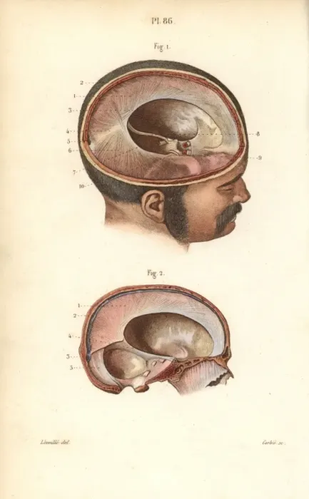 Framed Print : Cross sections through the skull Framed Print : Cross sections through the skull