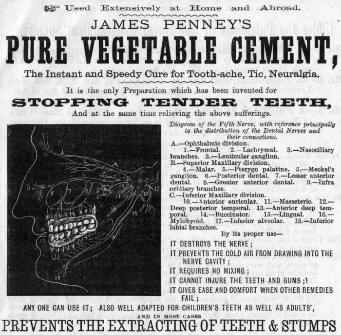 Framed Print : Dental advert, Pure Vegetable Cement Framed Print : Dental advert, Pure Vegetable Cement