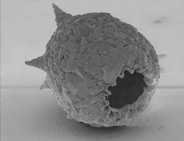 Difflugia Corona. Freshwater Testate Amoebae. Magnification x 450