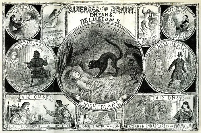 Framed Print : Diseases of the Brain Framed Print : Diseases of the Brain