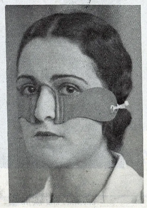 Framed Print : The Elizabeth Arden eye strap was made of soft rubber, and was intended to mitigate puffiness beneath the eyes. Date: circa 1932 Framed Print : The Elizabeth Arden eye strap was made of soft rubber, and was intended to mitigate puffiness beneath the eyes. Date: circa 1932