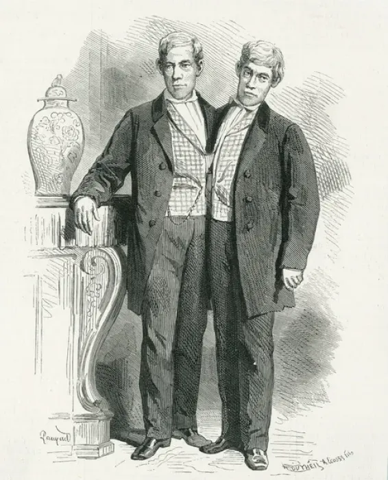 Framed Print : Eng and Chang, Siamese twins Framed Print : Eng and Chang, Siamese twins