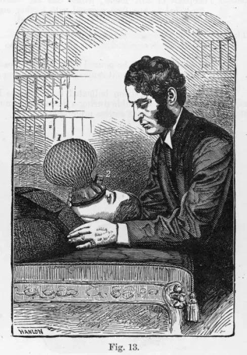 Framed Print : Ether / Anaesthetics / 1885 Framed Print : Ether / Anaesthetics / 1885