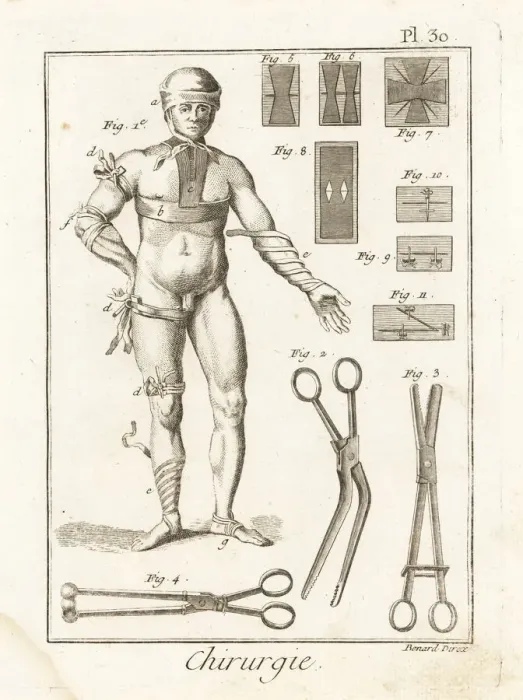 Framed Print : Examples of 18th century bandages, tongs and sutures Framed Print : Examples of 18th century bandages, tongs and sutures