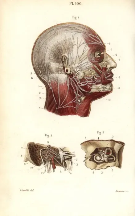 Framed Print : Facial and auditory nerves Framed Print : Facial and auditory nerves