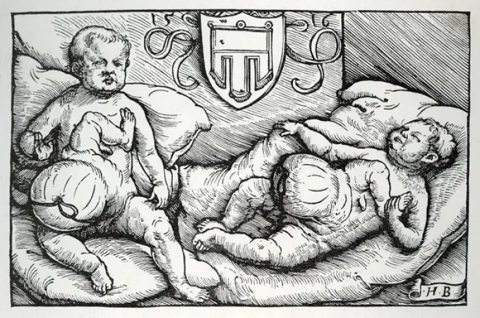 Framed Print : Freak Birth / Early C16 Framed Print : Freak Birth / Early C16