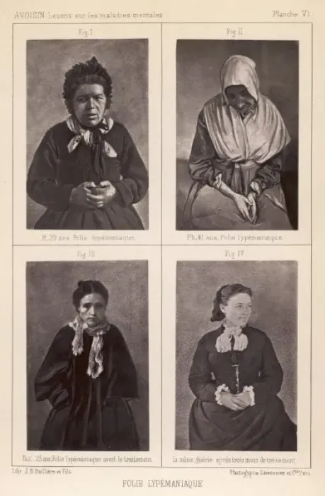 Framed Print : French Mental Patients 2 Framed Print : French Mental Patients 2