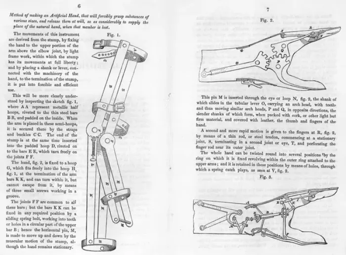 Framed Print : George Cayleys design for an artificial hand Framed Print : George Cayleys design for an artificial hand