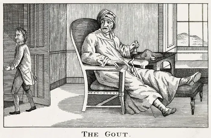 Framed Print : A gouty invalid angrily rings for his manservant, presumably to fetch him some more port! Date: 18th century Framed Print : A gouty invalid angrily rings for his manservant, presumably to fetch him some more port! Date: 18th century