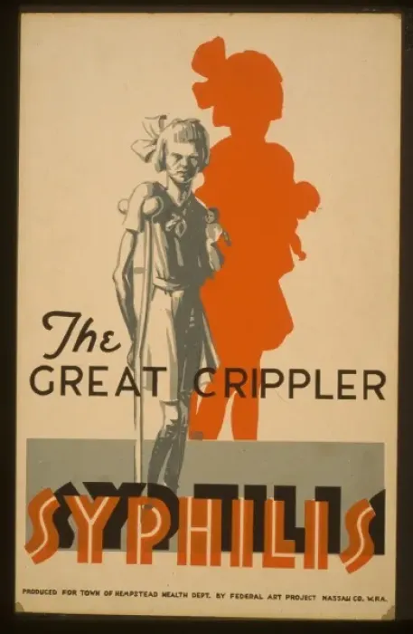 Framed Print : The great crippler - syphilis Framed Print : The great crippler - syphilis