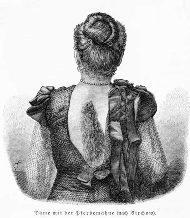 Framed Print : Hair on Back Framed Print : Hair on Back