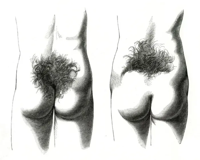 Framed Print : Hair in Small of Back Framed Print : Hair in Small of Back