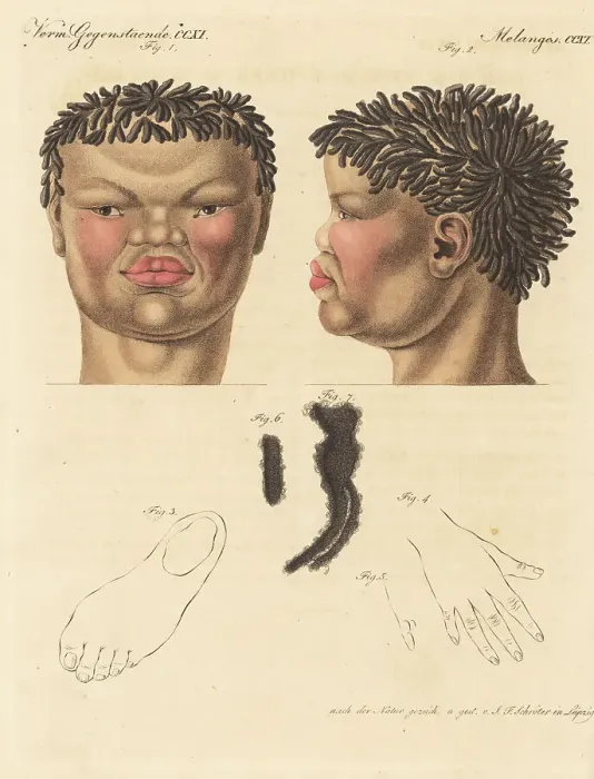 Framed Print : Head of a 20-year-old Khoekhoe man of South Africa, 1814