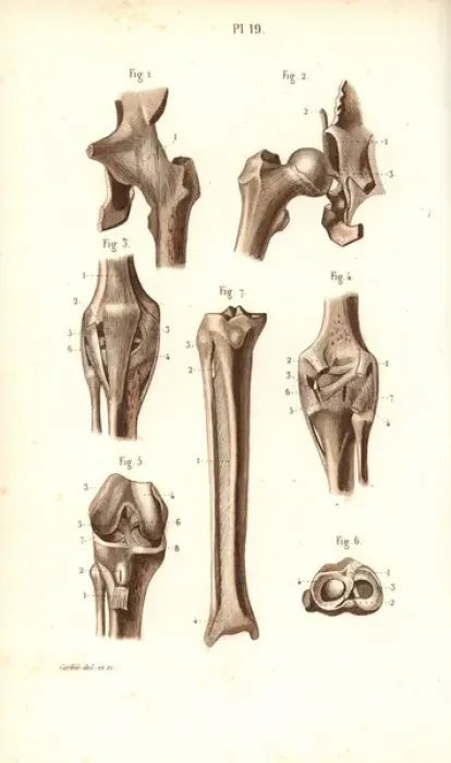 Framed Print : Hip joint and thigh bones Framed Print : Hip joint and thigh bones