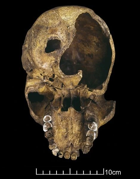 Homo heildelbergensis, Rhodesian or Broken Hill Man (Broken