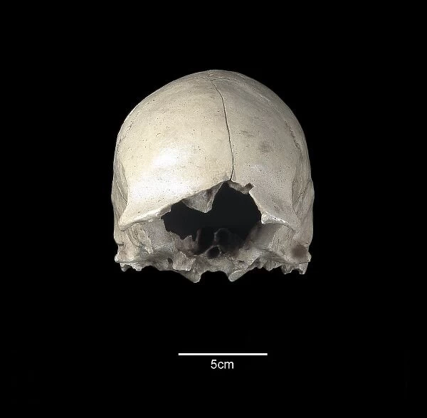Homo sapiens cranium (Stetten 1)