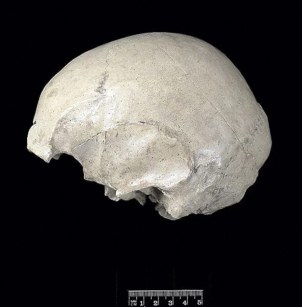 Homo sapiens cranium (Stetten 1)