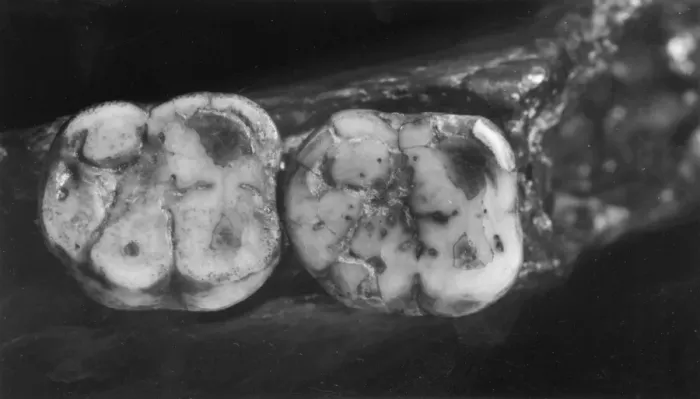 Framed Print : Homo sapiens molars (Piltdown 1) Framed Print : Homo sapiens molars (Piltdown 1)