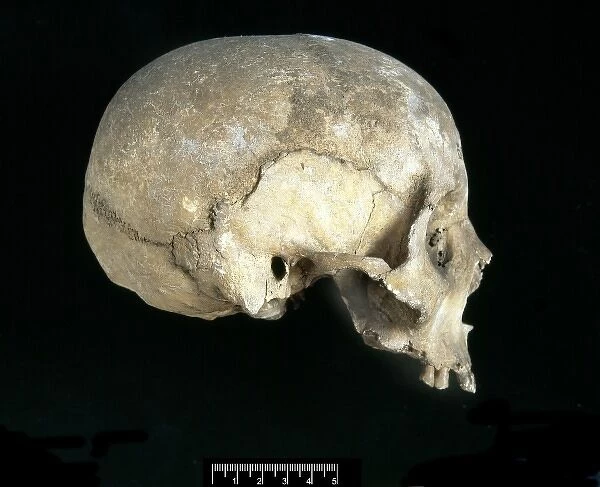 Homo sapiens skull (Italy)