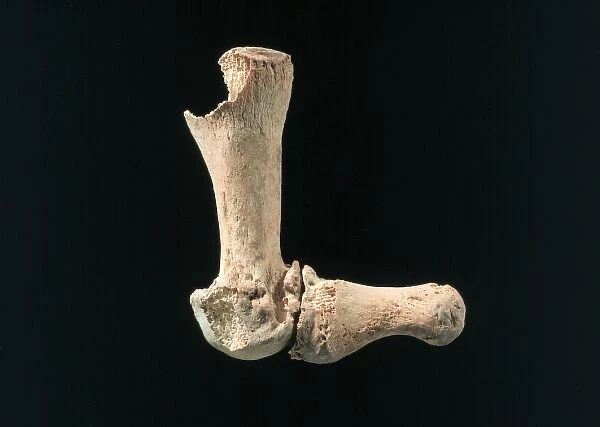 Human bones found at Abu Hureyra
