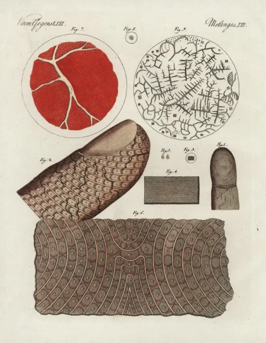 Framed Print : Human finger, skin, blood, serum and salt crystals Framed Print : Human finger, skin, blood, serum and salt crystals