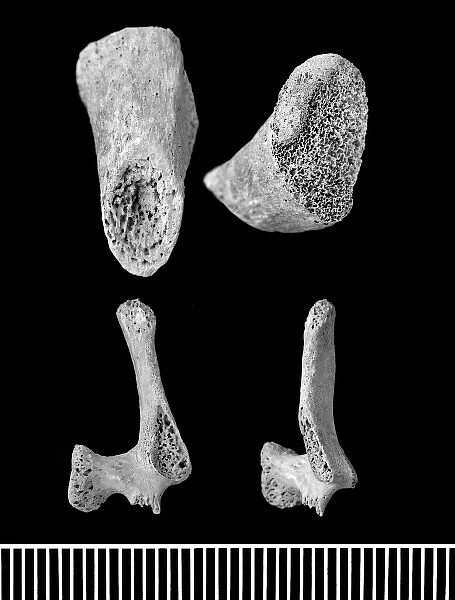 Part of human perinatal skeleton