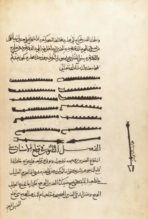 Framed Print : Huntington Manuscript. Surgical techniques by Framed Print : Huntington Manuscript. Surgical techniques by