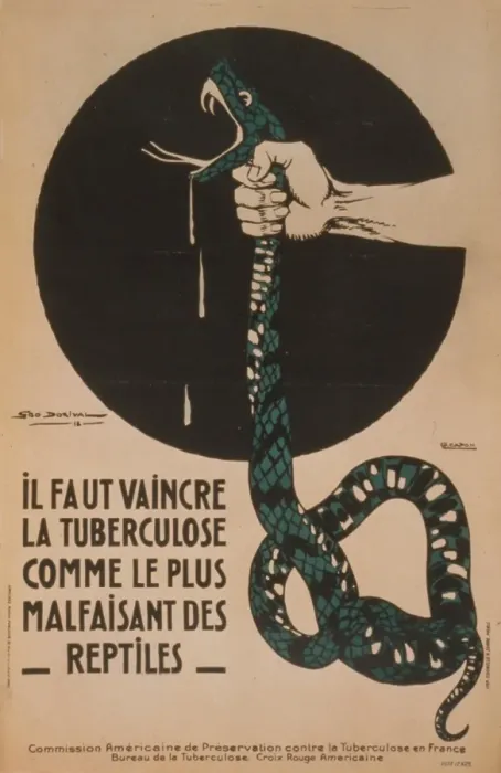 Framed Print : Il faut vaincre la tuberculose comme le plus malfaisant des Framed Print : Il faut vaincre la tuberculose comme le plus malfaisant des