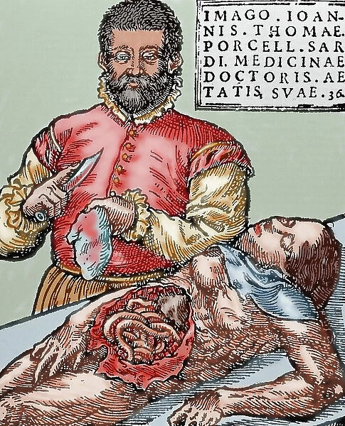John Thomas Porcell (1528-ca. 1580). Spanish doctor