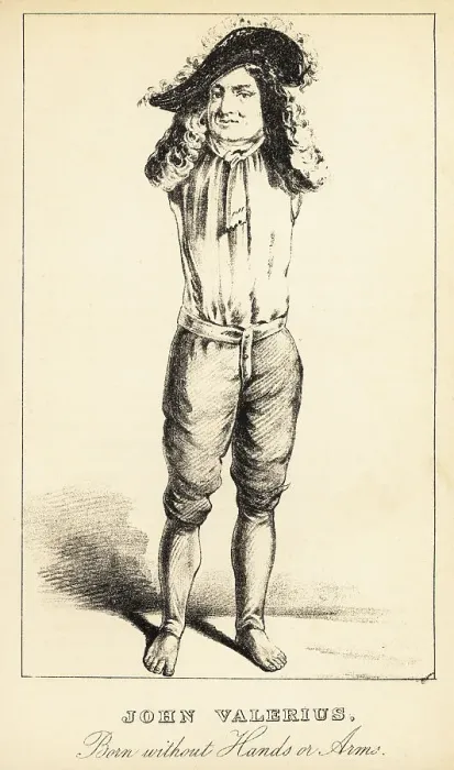 Framed Print : John Valerius, born without hands or arms, 18th century Framed Print : John Valerius, born without hands or arms, 18th century