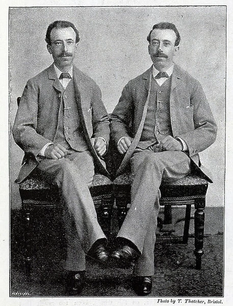 Johnson twins of Bristol