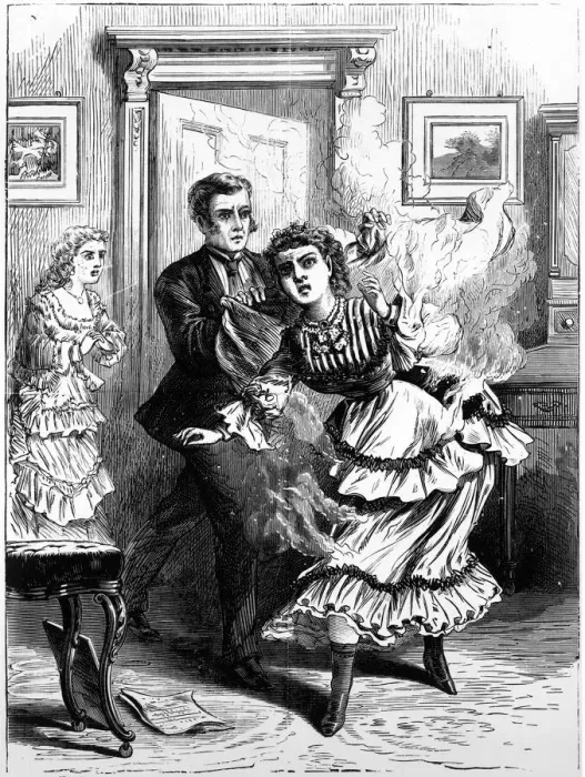 Framed Print : Lady badly burned in an accident with a paraffin lamp Framed Print : Lady badly burned in an accident with a paraffin lamp