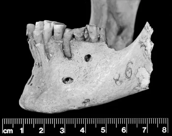 Framed Print : Lateral view of mandible Framed Print : Lateral view of mandible