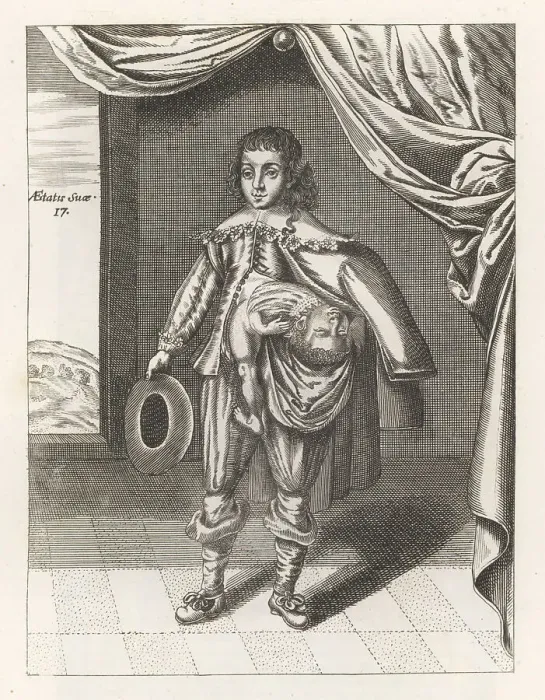 Framed Print : Lazarus and John Baptista Colloredo, parasitic twins, 17th centu