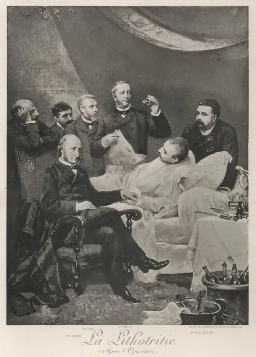 Framed Print : Lithotritie Operation Framed Print : Lithotritie Operation
