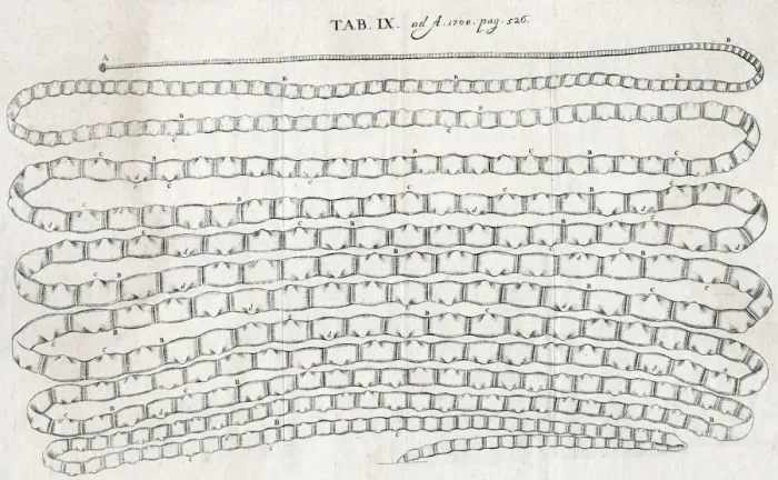 Framed Print : LONG WORM. A tapeworm taken from a patient in Paris by Dr Nicolas ?Antry Framed Print : LONG WORM. A tapeworm taken from a patient in Paris by Dr Nicolas ?Antry